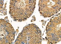 Invitrogen KDEL Receptor Pan Polyclonal Antibody 100 &mu;L; Unconjugated:Antibodies,