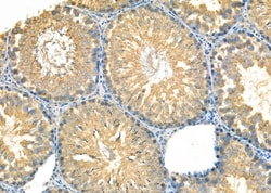 Invitrogen KDEL Receptor Pan Polyclonal Antibody 100 &mu;L; Unconjugated:Antibodies,