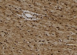 Invitrogen KIFC1 Polyclonal Antibody 100 &mu;L; Unconjugated:Antibodies,