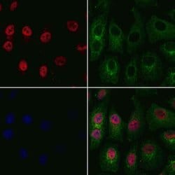 Invitrogen OTX1 Polyclonal Antibody 100 &mu;L; Unconjugated:Antibodies,