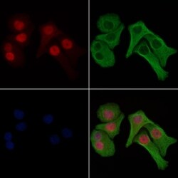 Phospho-Histone H1.3 (Thr18) Polyclonal Antibody, Invitrogen 100 &mu;L;
