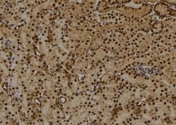 Phospho-Histone H1.3 (Thr18) Polyclonal Antibody, Invitrogen 100 &mu;L;