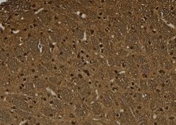 Invitrogen Phospho-HSF1 (Ser326) Polyclonal Antibody 100 &mu;L | Buy Online | Invitrogen&trade; | Fisher Scientific