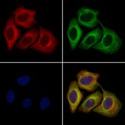 Invitrogen PMEL Polyclonal Antibody 100 &mu;L; Unconjugated:Antibodies,