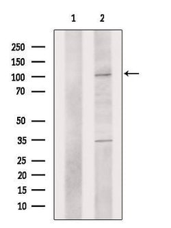 Invitrogen PMEL Polyclonal Antibody 100 &mu;L; Unconjugated:Antibodies,