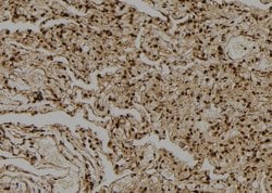Invitrogen PP1 alpha/beta Polyclonal Antibody 100 &mu;L | Buy Online | Invitrogen&trade; | Fisher Scientific