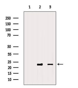 Invitrogen RAB9 Polyclonal Antibody 100 &mu;L; Unconjugated:Antibodies,
