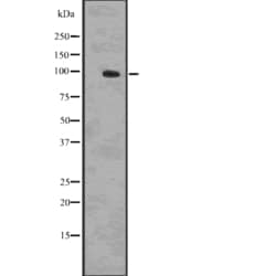 Invitrogen Phospho-beta Catenin (Ser33, Ser37, Thr41) Polyclonal Antibody