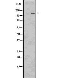 Invitrogen LRP6 Polyclonal Antibody 100 &mu;L | Buy Online | Invitrogen&trade; | Fisher Scientific