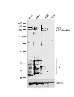 Invitrogen LRP6 Polyclonal Antibody 100 &mu;L | Buy Online | Invitrogen&trade; | Fisher Scientific