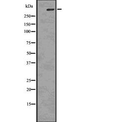 Invitrogen Phospho-IP3 Receptor 1 (Ser1756) Polyclonal Antibody 100 &mu;L | Buy Online | Invitrogen&trade; | Fisher Scientific