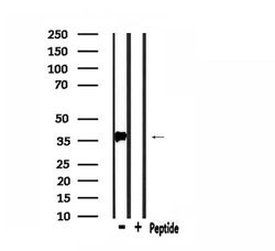 Invitrogen PDLIM1 Polyclonal Antibody 100 &mu;L | Buy Online | Invitrogen&trade; | Fisher Scientific