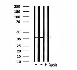 Invitrogen PDLIM1 Polyclonal Antibody 100 &mu;L | Buy Online | Invitrogen&trade; | Fisher Scientific