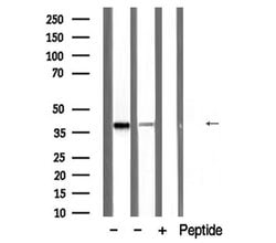 Invitrogen PDLIM1 Polyclonal Antibody 100 &mu;L | Buy Online | Invitrogen&trade; | Fisher Scientific