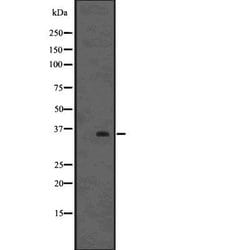 Invitrogen FOXE1 Polyclonal Antibody 100 &mu;L | Buy Online | Invitrogen&trade; | Fisher Scientific