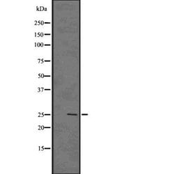 Invitrogen GSC2 Polyclonal Antibody 100 &mu;L; Unconjugated:Antibodies,
