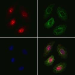 Invitrogen PHF1 Polyclonal Antibody 100 &mu;L; Unconjugated:Antibodies,