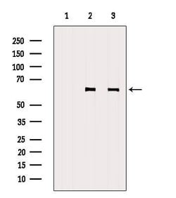 Invitrogen PHF1 Polyclonal Antibody 100 &mu;L; Unconjugated:Antibodies,