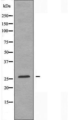 Invitrogen ANP32C Polyclonal Antibody 100 &mu;L; Unconjugated:Antibodies,