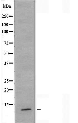 Invitrogen TUSC2 Polyclonal Antibody 100 &mu;L | Buy Online | Invitrogen&trade; | Fisher Scientific