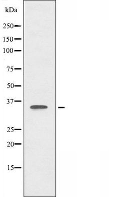 Invitrogen ALX3 Polyclonal Antibody 100 &mu;L; Unconjugated:Antibodies,