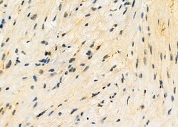 TOP3B Polyclonal Antibody:Antibodies, Polyclonal