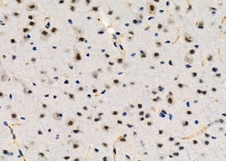 TOP3B Polyclonal Antibody:Antibodies, Polyclonal