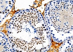 TOP3B Polyclonal Antibody:Antibodies, Polyclonal