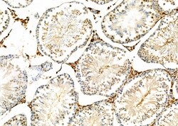 TOP3B Polyclonal Antibody:Antibodies, Polyclonal