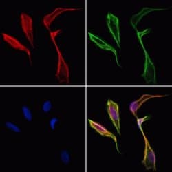 Invitrogen PFKFB1 Polyclonal Antibody 100 &mu;L; Unconjugated:Antibodies,