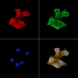 UBF-1 Polyclonal Antibody:Antibodies, Polyclonal