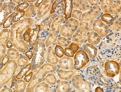 Invitrogen PFKL Polyclonal Antibody 100 &mu;L; Unconjugated:Antibodies,