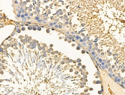 Invitrogen PFKL Polyclonal Antibody 100 &mu;L; Unconjugated:Antibodies,