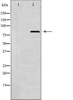 Invitrogen PFKL Polyclonal Antibody 100 &mu;L; Unconjugated:Antibodies,