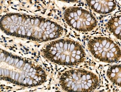 Invitrogen ATF3 Polyclonal Antibody 100 &mu;L | Buy Online | Invitrogen&trade; | Fisher Scientific