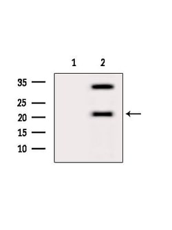 Invitrogen ATF3 Polyclonal Antibody 100 &mu;L | Buy Online | Invitrogen&trade; | Fisher Scientific