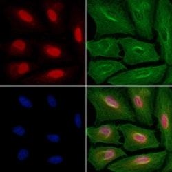Invitrogen CDK11B Polyclonal Antibody 100 &mu;L; Unconjugated:Antibodies,