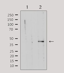 Invitrogen PKA gamma Polyclonal Antibody 100 &mu;L; Unconjugated:Antibodies,