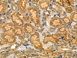 Invitrogen PKA gamma Polyclonal Antibody 100 &mu;L; Unconjugated:Antibodies,