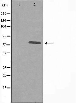 ITPKA Polyclonal Antibody:Antibodies, Polyclonal