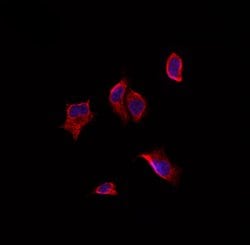 AKAP5 Polyclonal Antibody:Antibodies, Polyclonal
