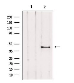 AKAP5 Polyclonal Antibody:Antibodies, Polyclonal