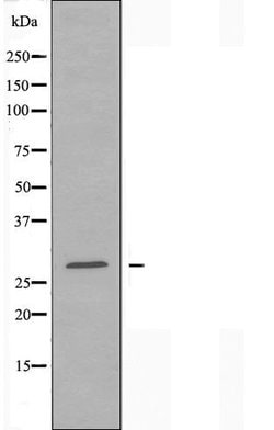 Invitrogen NFYB Polyclonal Antibody 100 &mu;L | Buy Online | Invitrogen&trade; | Fisher Scientific