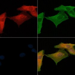 Invitrogen PTX3 Polyclonal Antibody 100 &mu;L; Unconjugated:Antibodies,