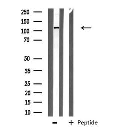 Invitrogen ITPKB Polyclonal Antibody 100 &mu;L; Unconjugated:Antibodies,