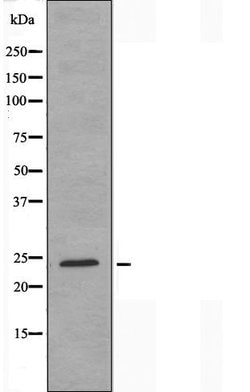 Invitrogen HOXA7 Polyclonal Antibody 100 &mu;L; Unconjugated:Antibodies,