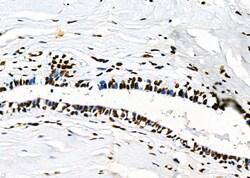 Invitrogen PRKAR1B Polyclonal Antibody 100 &mu;L | Buy Online | Invitrogen&trade; | Fisher Scientific