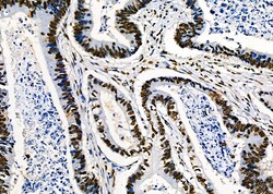 Invitrogen PRKAR1B Polyclonal Antibody 100 &mu;L | Buy Online | Invitrogen&trade; | Fisher Scientific