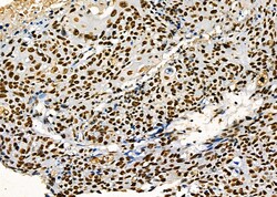 Invitrogen PRKAR1B Polyclonal Antibody 100 &mu;L | Buy Online | Invitrogen&trade; | Fisher Scientific