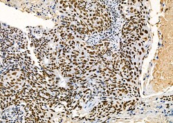 Invitrogen PRKAR1B Polyclonal Antibody 100 &mu;L | Buy Online | Invitrogen&trade; | Fisher Scientific